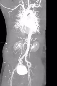 X-Ray Eros