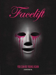 Facelift